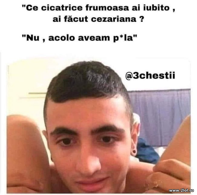 Ce cicatrice faina ai iubito | poze haioase