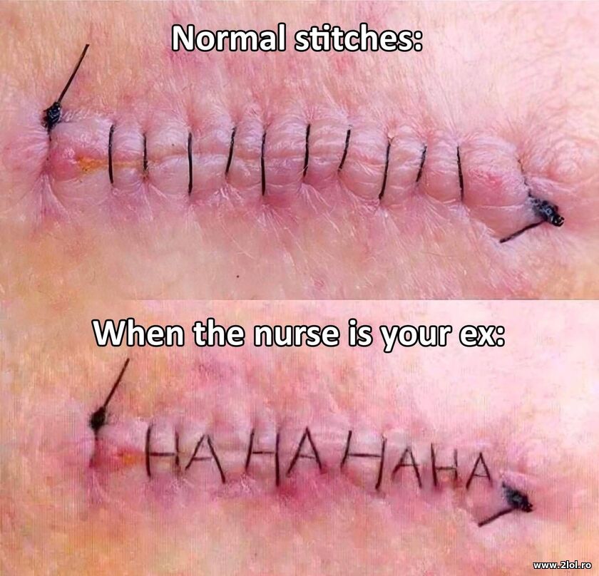 When the nurse is your ex | poze haioase